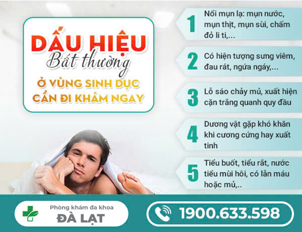 Hình ảnh minh họa